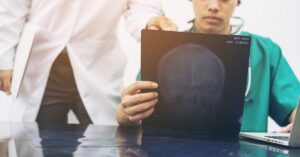 Ohio Traumatic Brain Injury Lawyer