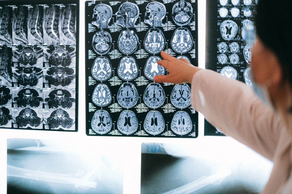 A close-up view of MRI scans, illustrating diagnostic imaging used to evaluate brain injuries and other medical conditions